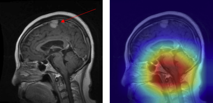 Mislocalized Attention Example