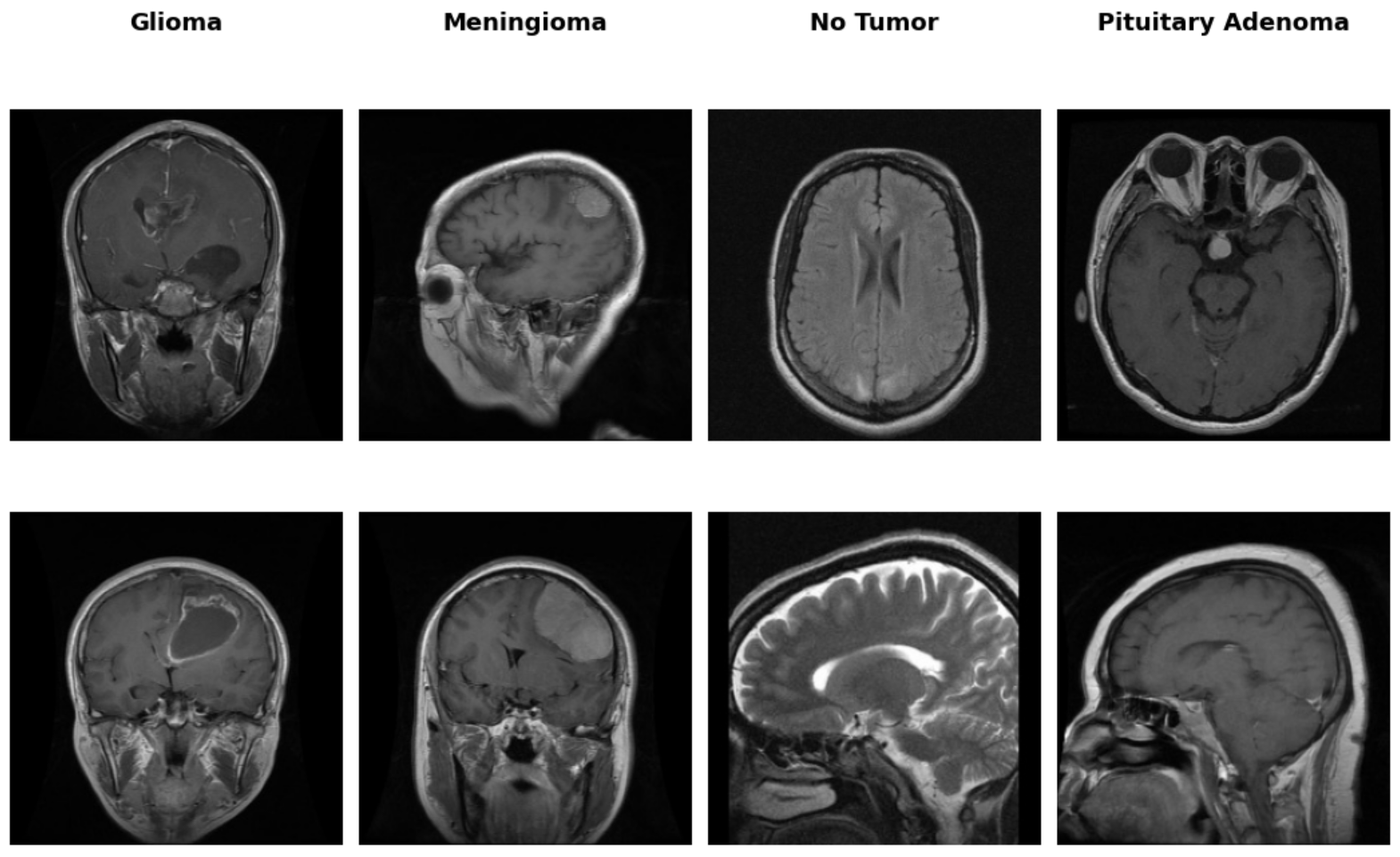 MRI Cross-Sections per Class